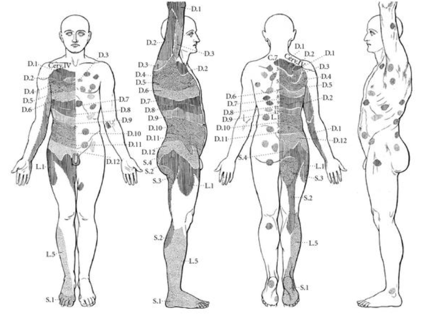 Sir Henry Head body pain diagram