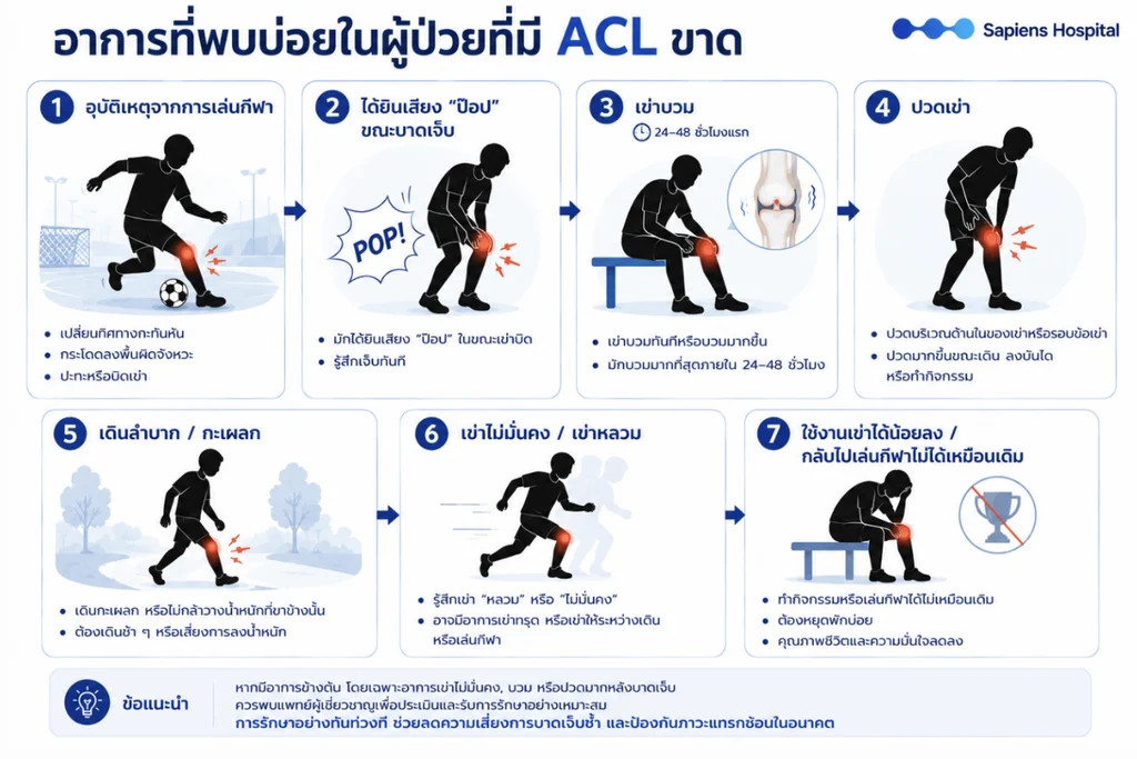 เอ็นไขว้หน้า ACL 