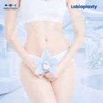 Labiaplasty
